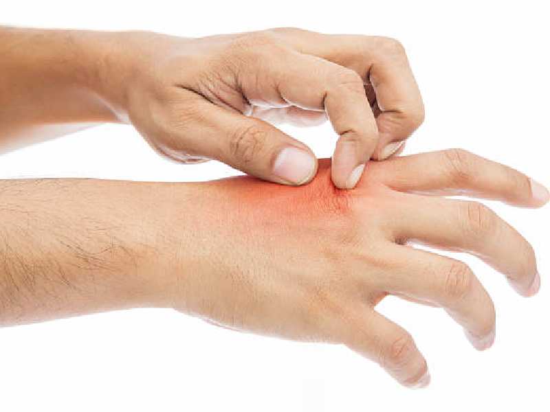 Can Laser Hair Reduction Burn your Skin?