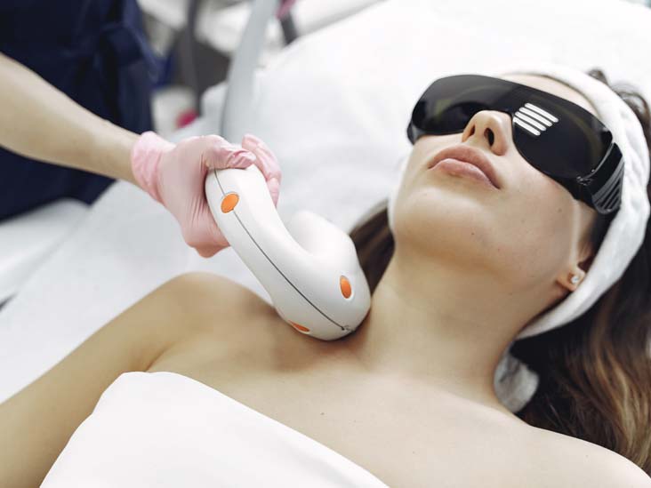 Laser hair removal -Faq
