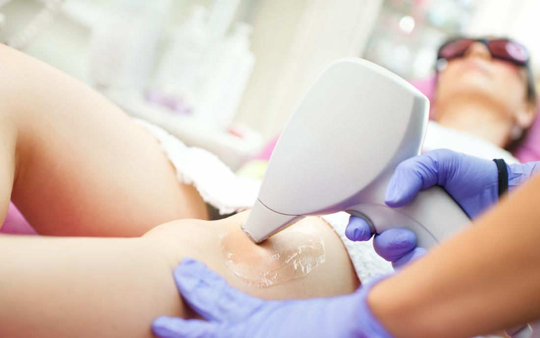 Post-Treatment Care for Laser Hair Removal in Delhi: Dos and Don'ts