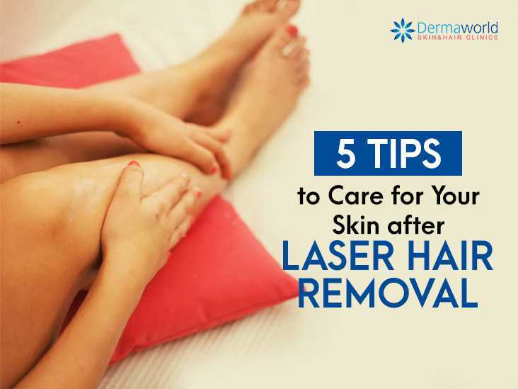 5 Tips to Care for Your Skin after Laser Hair Removal 5 Tips to Care for Your Skin after Laser Hair Removal