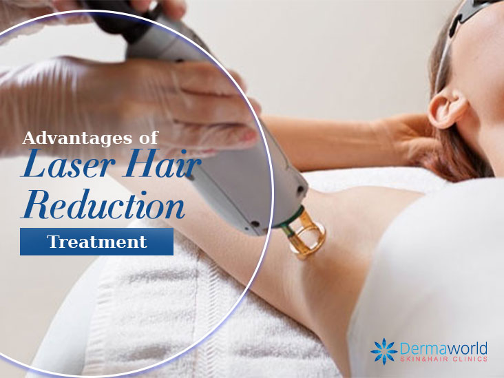 Advantages of Laser Hair Reduction Treatment