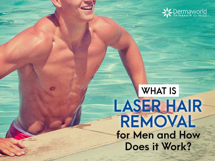 What is Laser Hair Removal for Men and How Does it Work?